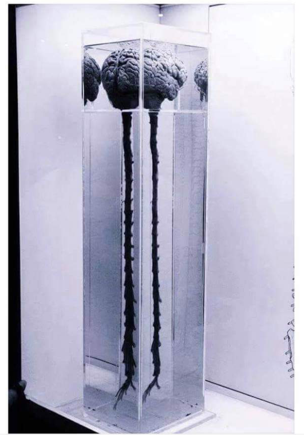 IMG_6733 - Brain Training. Neuro Science. Brain + Spinal Cord in tall container - From Internet - Original source unknown. www.TheHollyTreeTales.com